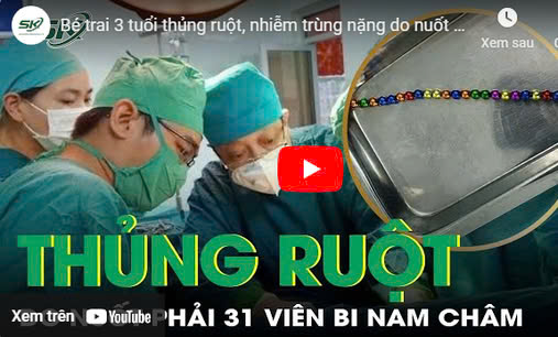  Bé trai 3 tuổi thủng ruột, nhiễm trùng nặng do nuốt 31 viên bi