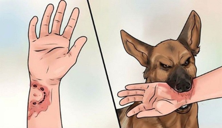 Cách tốt nhất phòng tránh bệnh dại