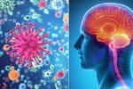 Cảnh báo các ca bệnh não mô cầu xâm lấn: Bệnh không phổ biến nhưng rất nguy hiểm