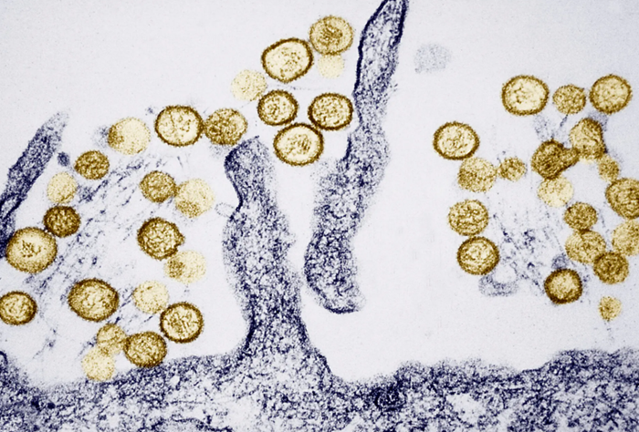 Đường lây chủ yếu của virus Hanta