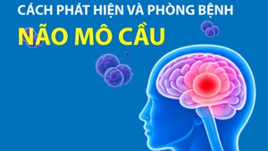 Infographics: Cách phát hiện và phòng bệnh não mô cầu